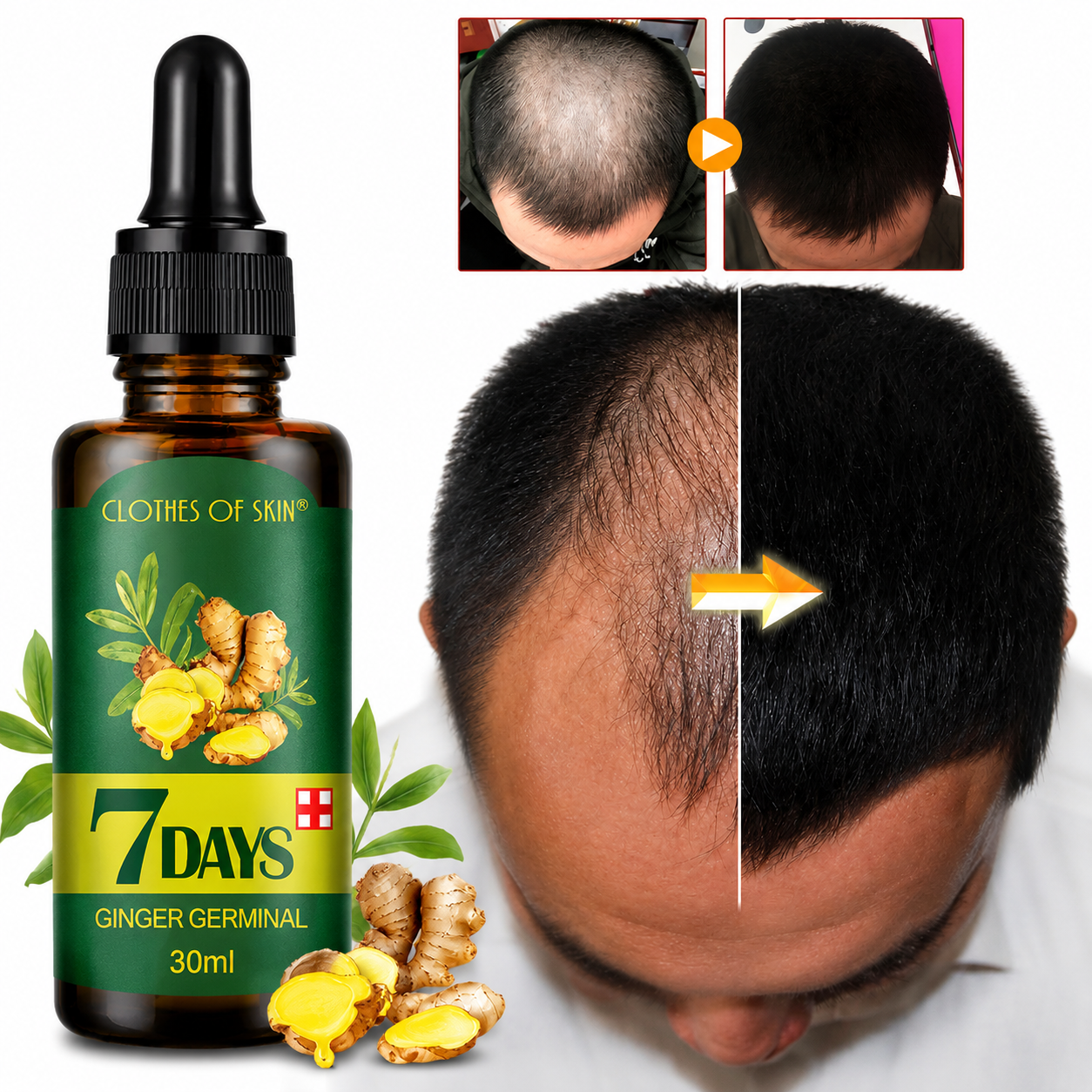 7Days Ginger Hair Growth Serum – Păr Mai Des și Mai Sănătos