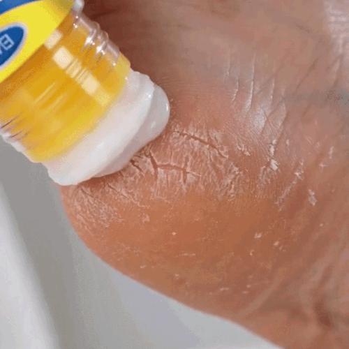 Cremă pentru Călcâie Crăpate – Reparare Intensivă